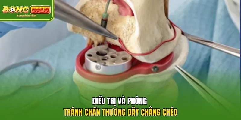 Điều trị và phòng tránh chấn thương dây chằng chéo